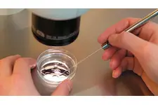 Tüp Bebek Aşılama Tüp Bebek Aşılama